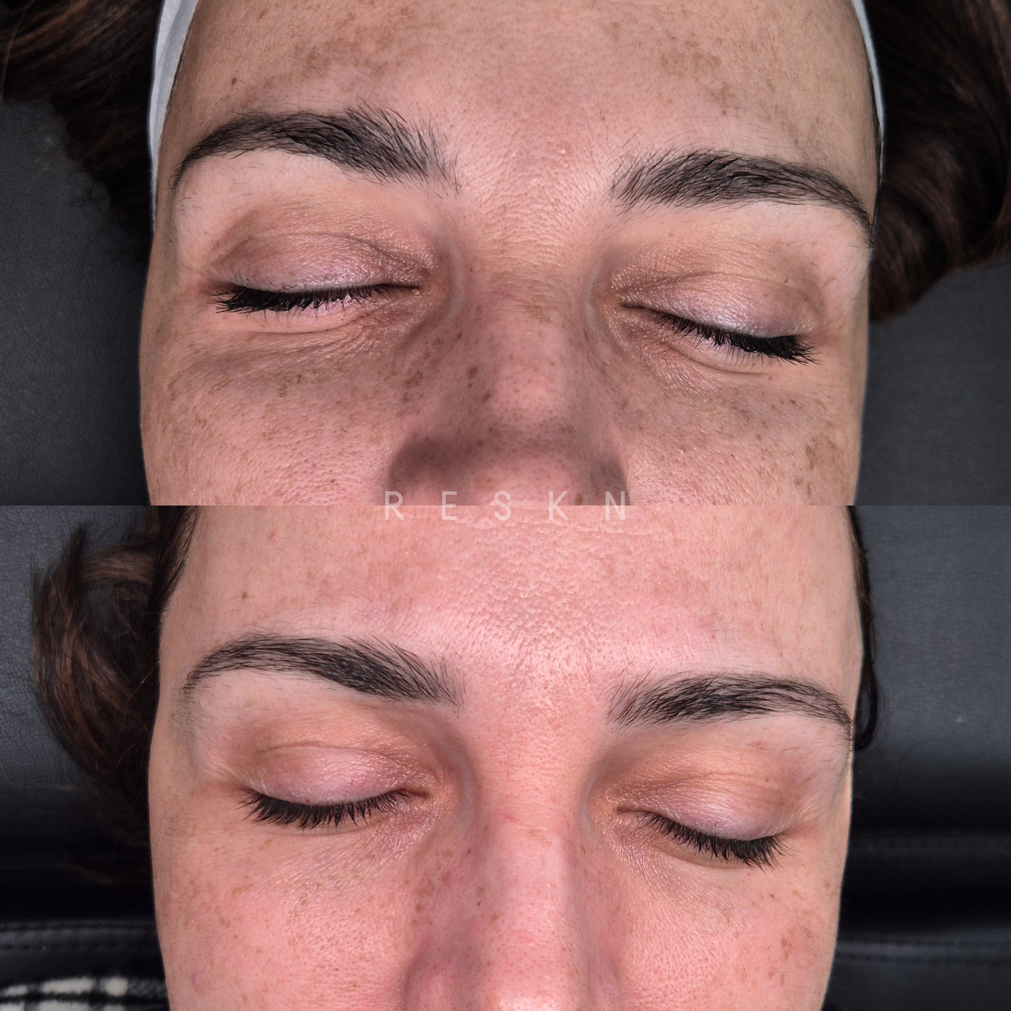 before&after