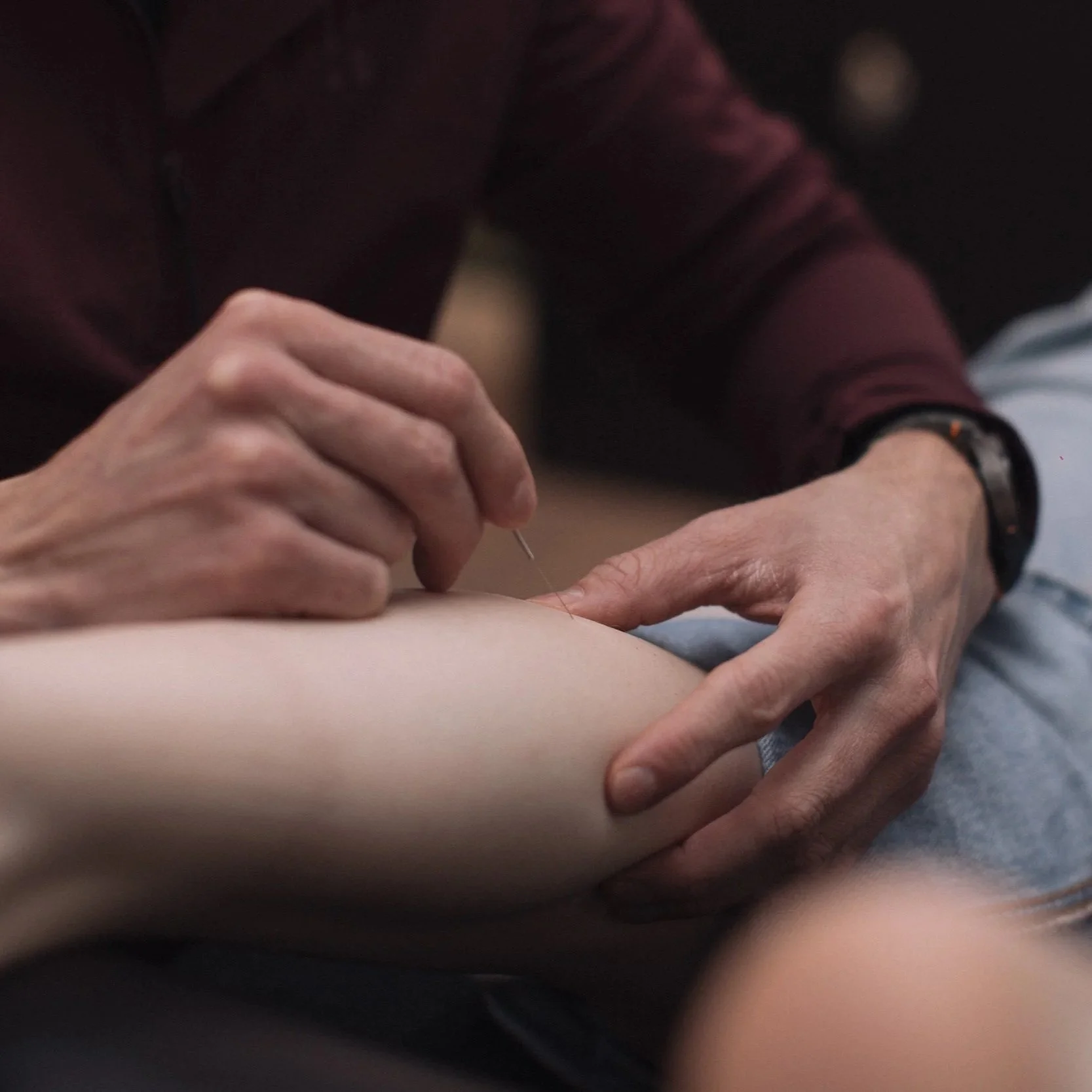 Dry Needling