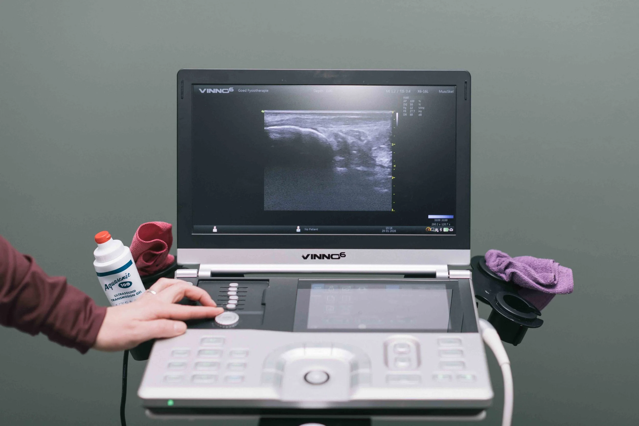 Goed Fysio Een medisch apparaat dat een echo-onderzoek uitvoert, met een computer en medische hulpmiddelen op de tafel voor een medische diagnose.