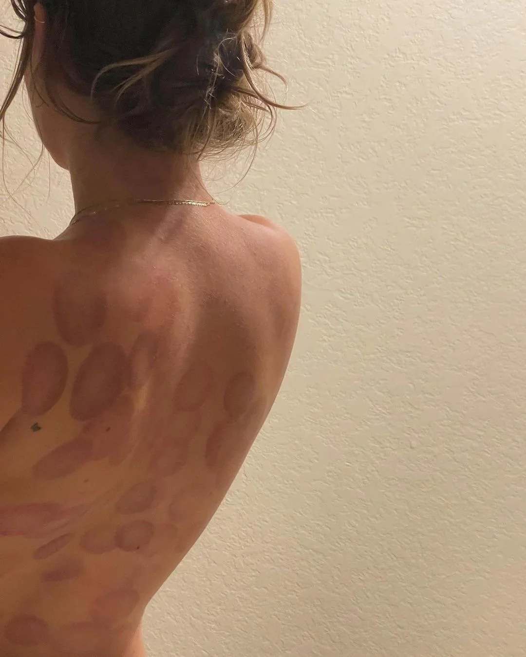 Acupuncturebeaudesert