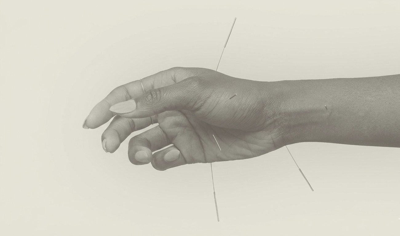 AcupunctureScenicRim