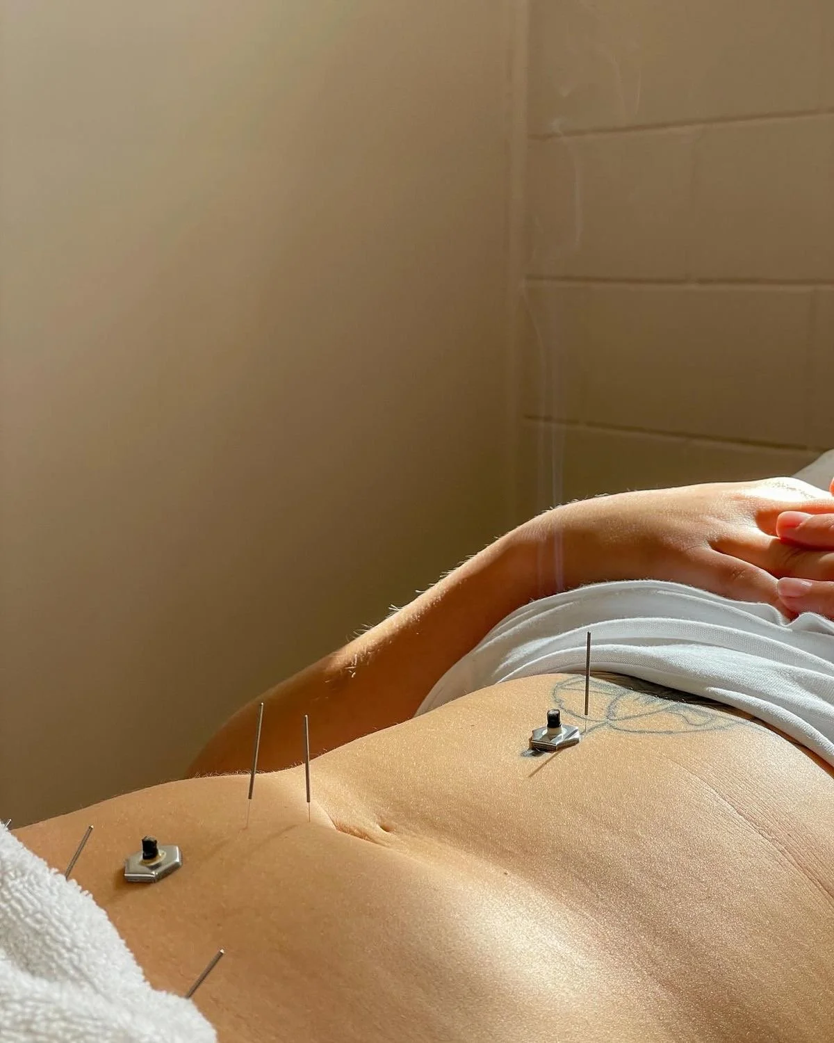 AcupunctureJimboomba