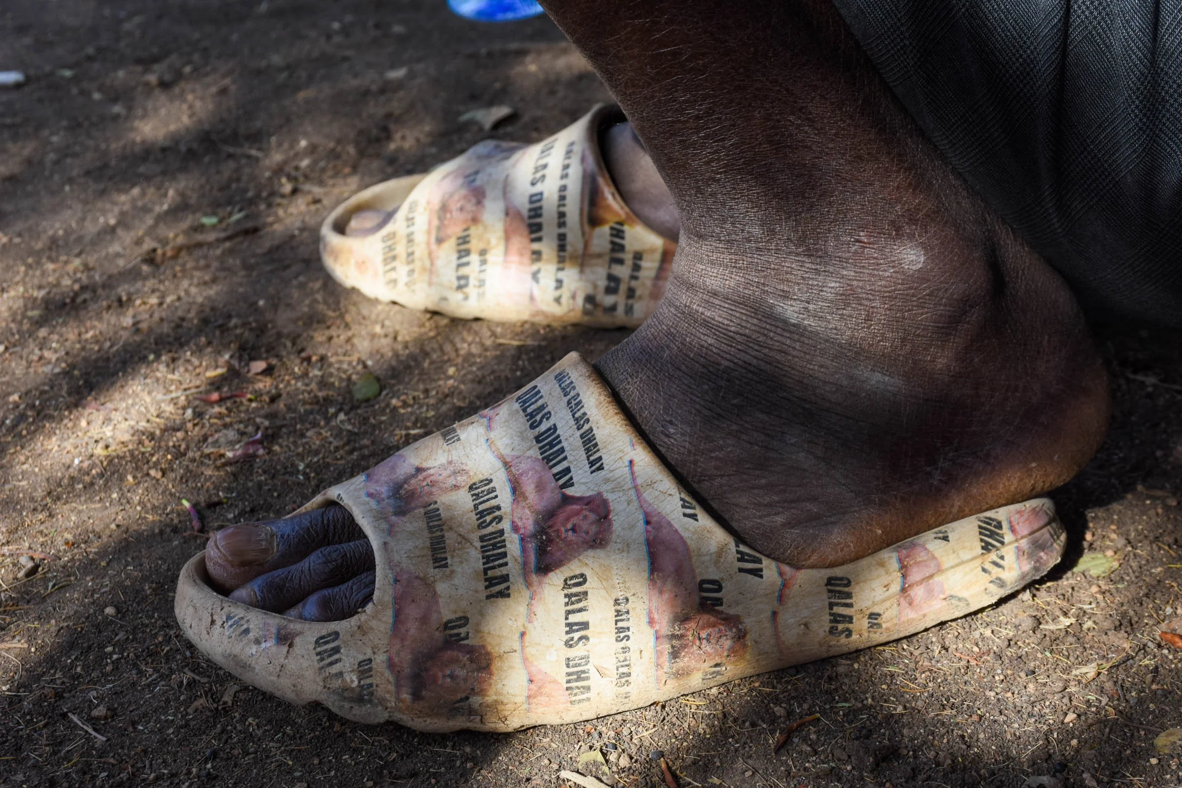 A pair of feet wearing white sandals decorated with faded images of lions