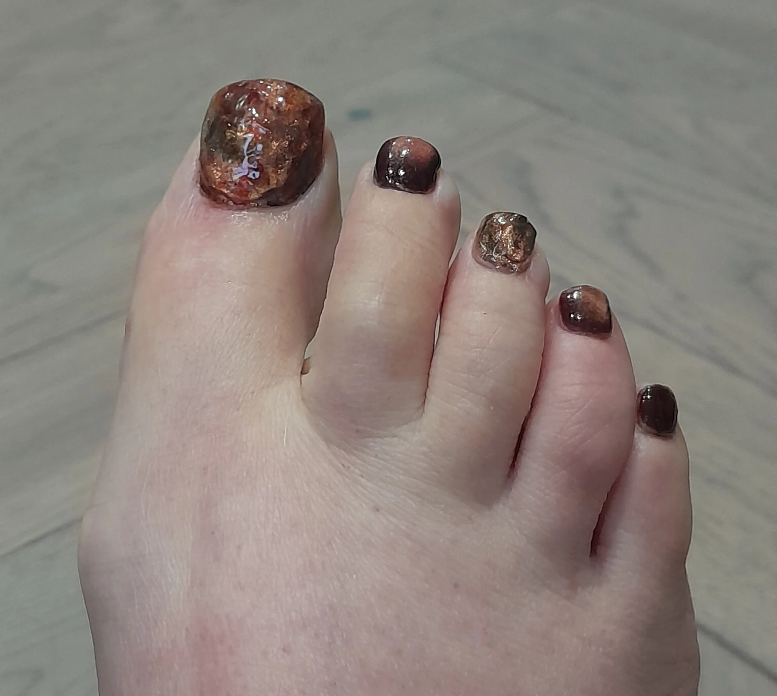 Fifth toe with dark, cracked, and damaged nail polish.