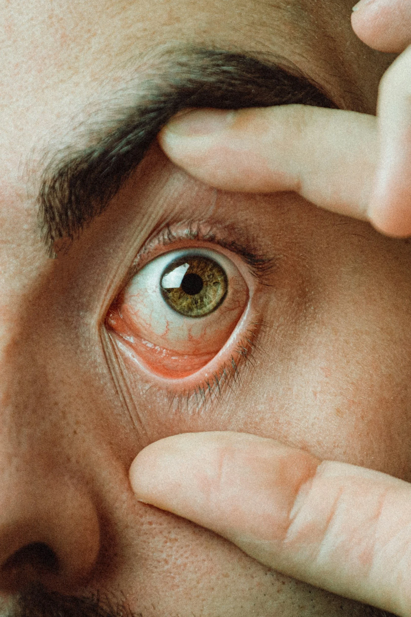 Contact Lenses: Are They Right for You?