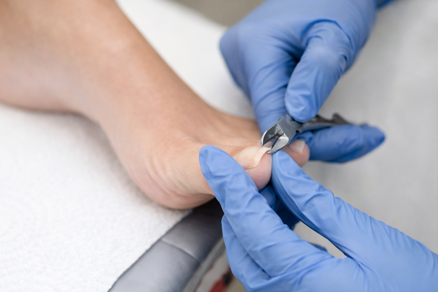 Toenail trim and burr/file