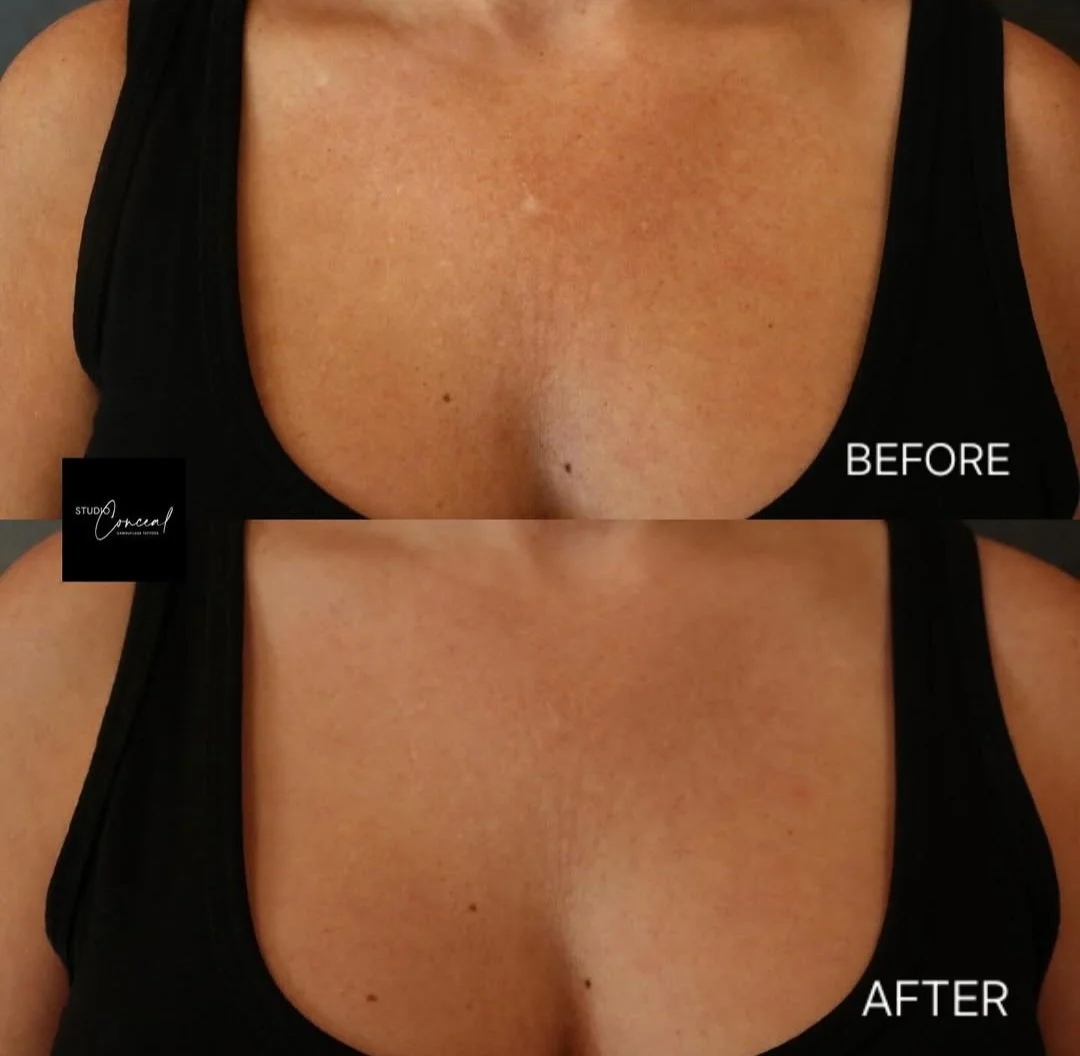 scar camouflage Reno NV