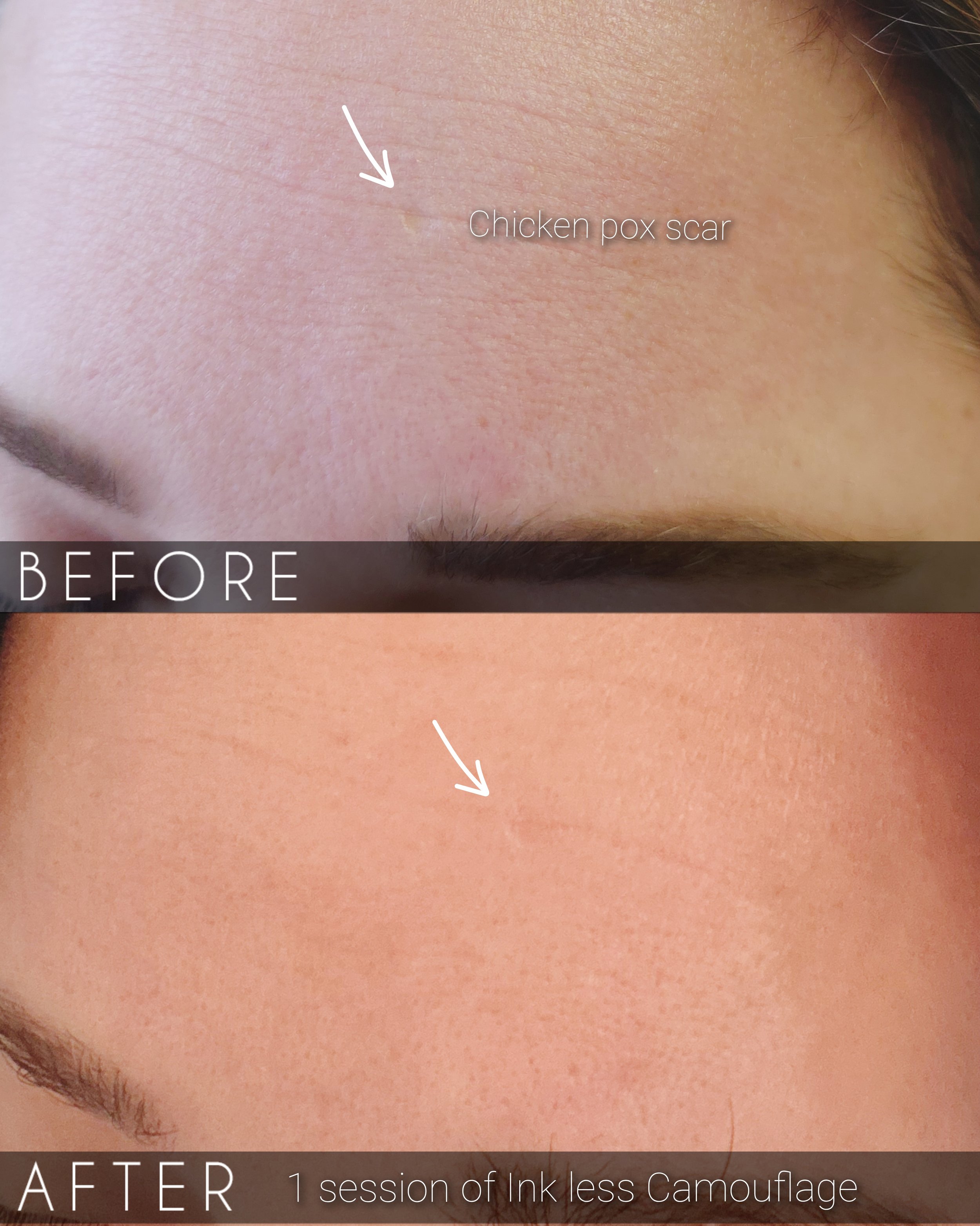 scar camouflage Reno NV