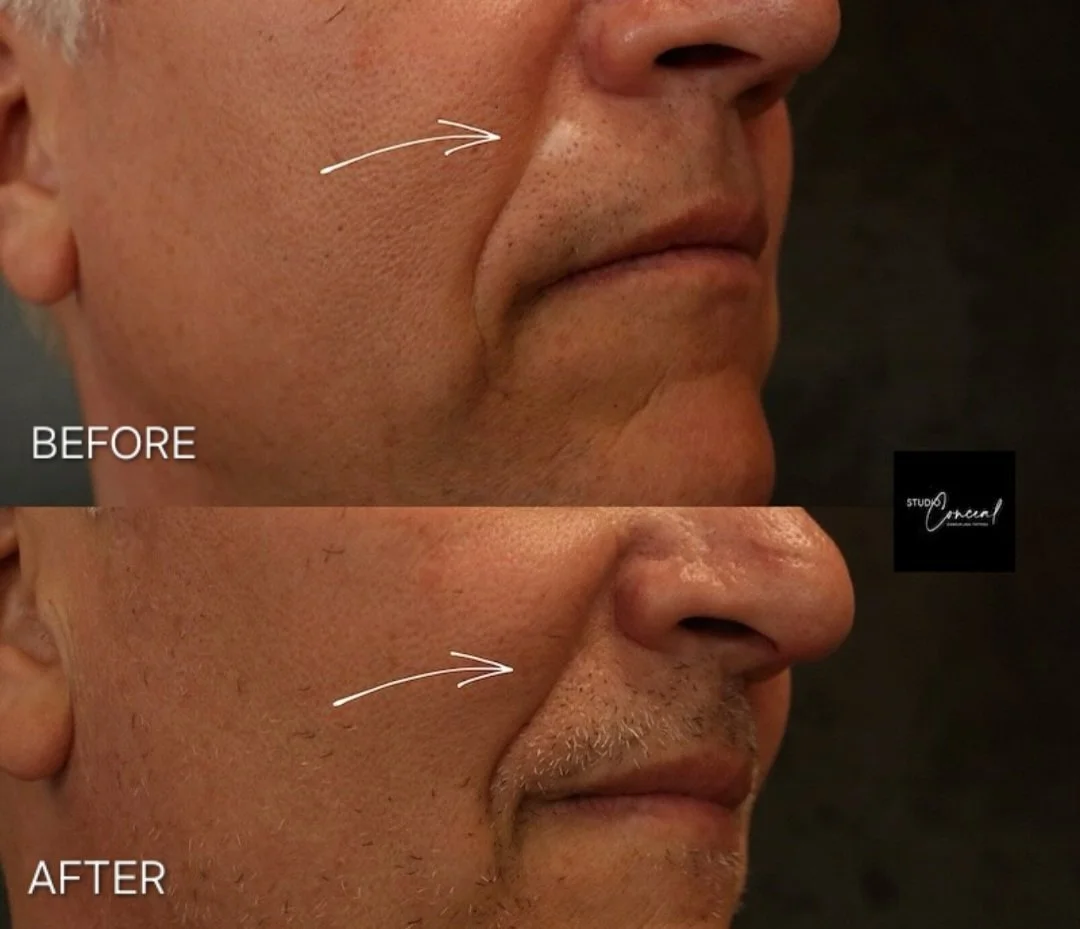 scar camouflage Reno NV