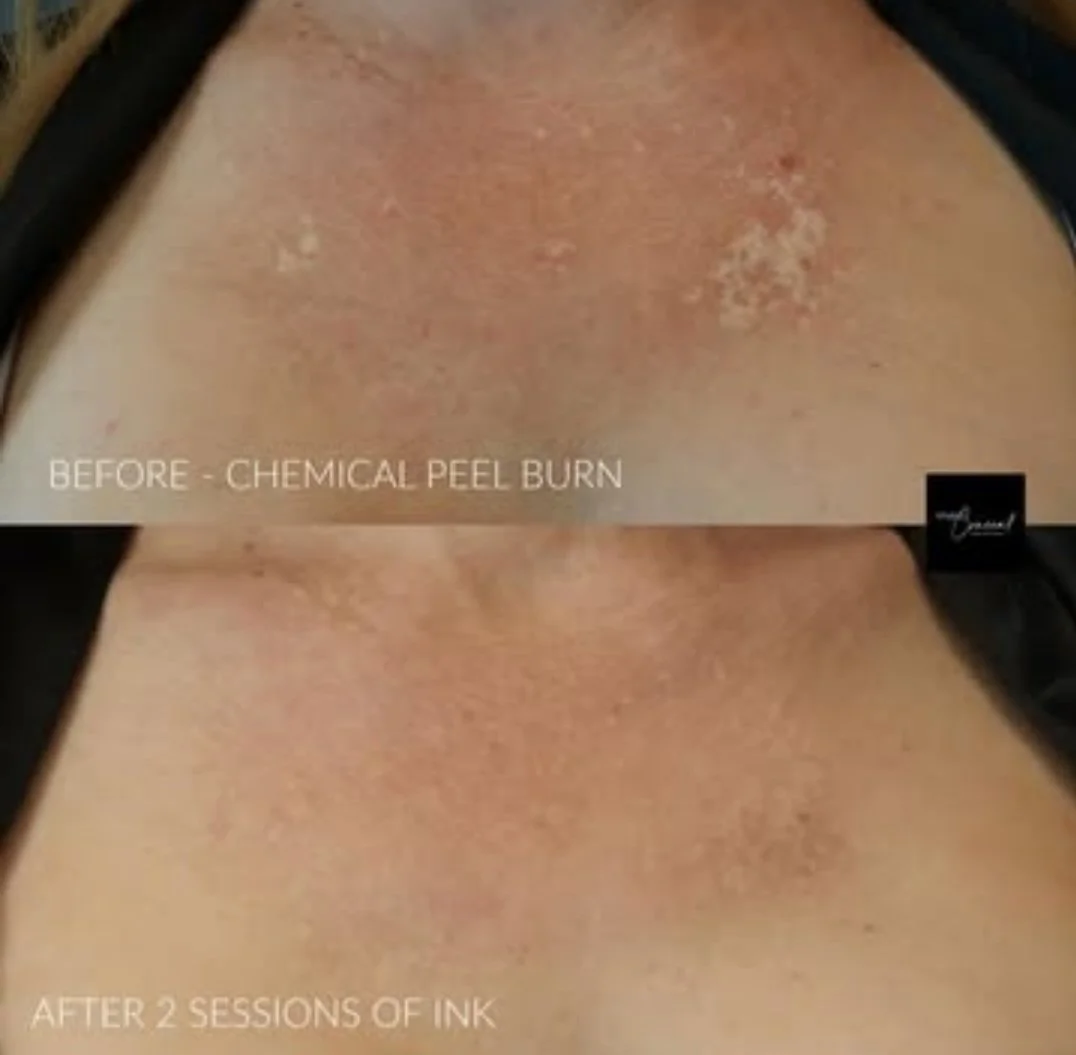 scar camouflage Reno NV