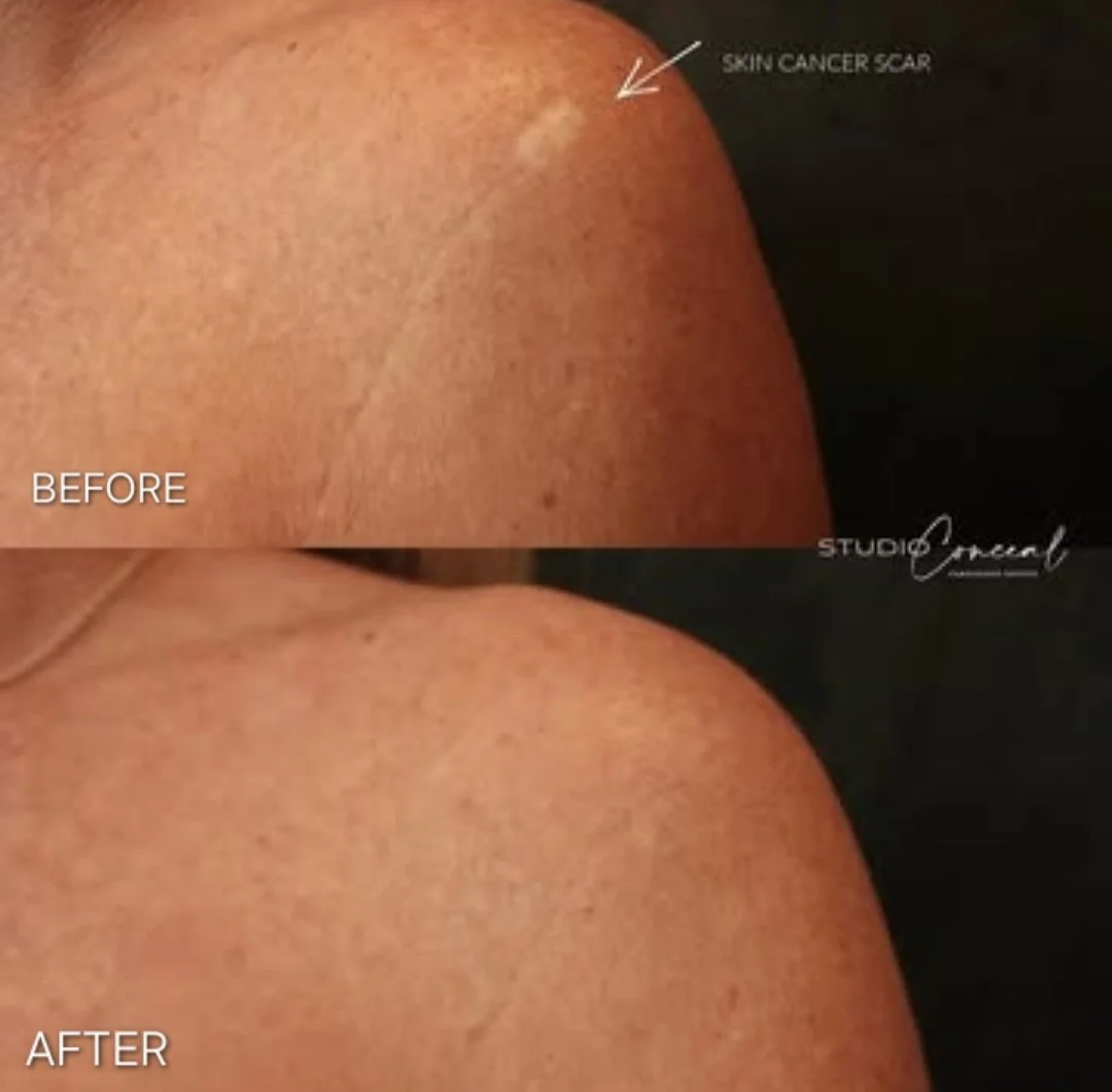 scar camouflage Reno NV