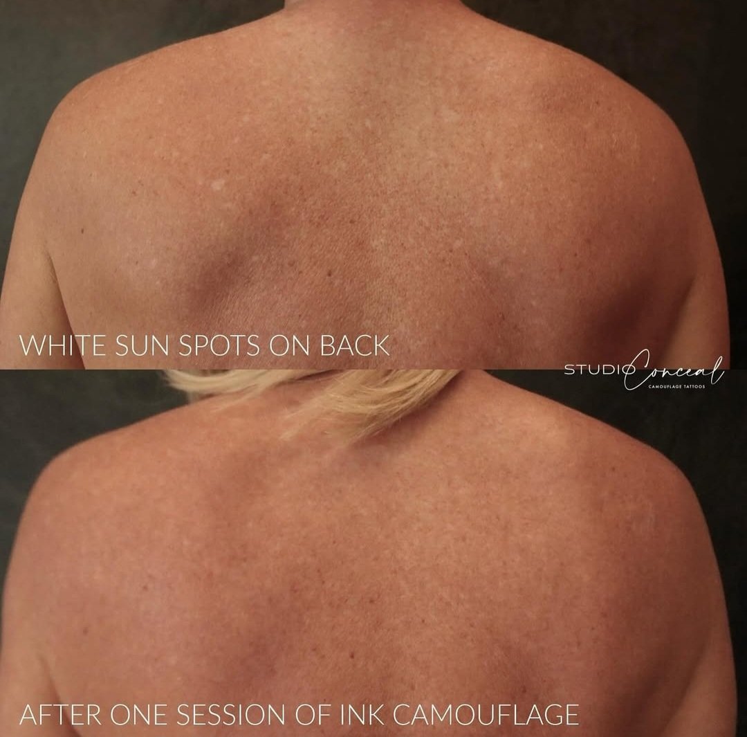 scar camouflage Reno NV