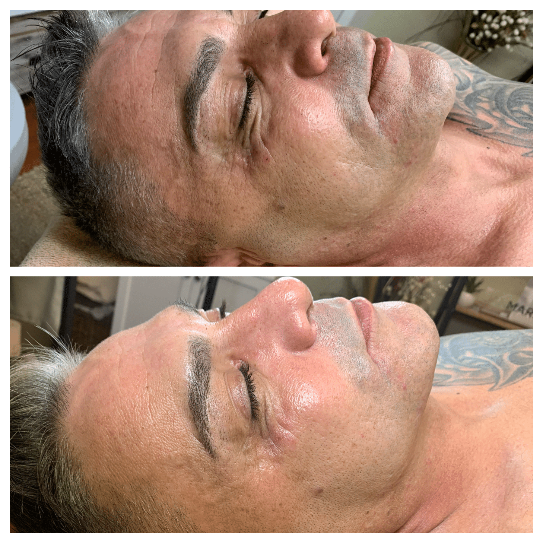 Side-by-side comparison of a man's face before and after a skincare treatment, showing improved skin texture and clarity.
