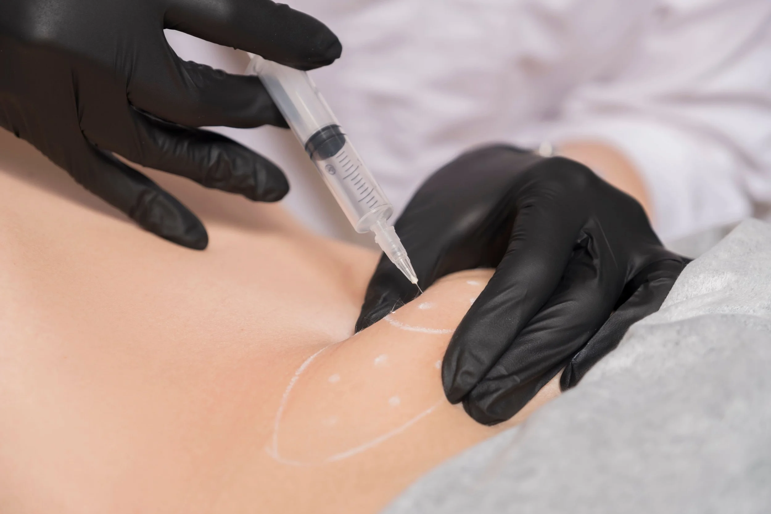 Une personne portant des gants noirs reçoit une injection avec une seringue dans le bras d'une autre personne.