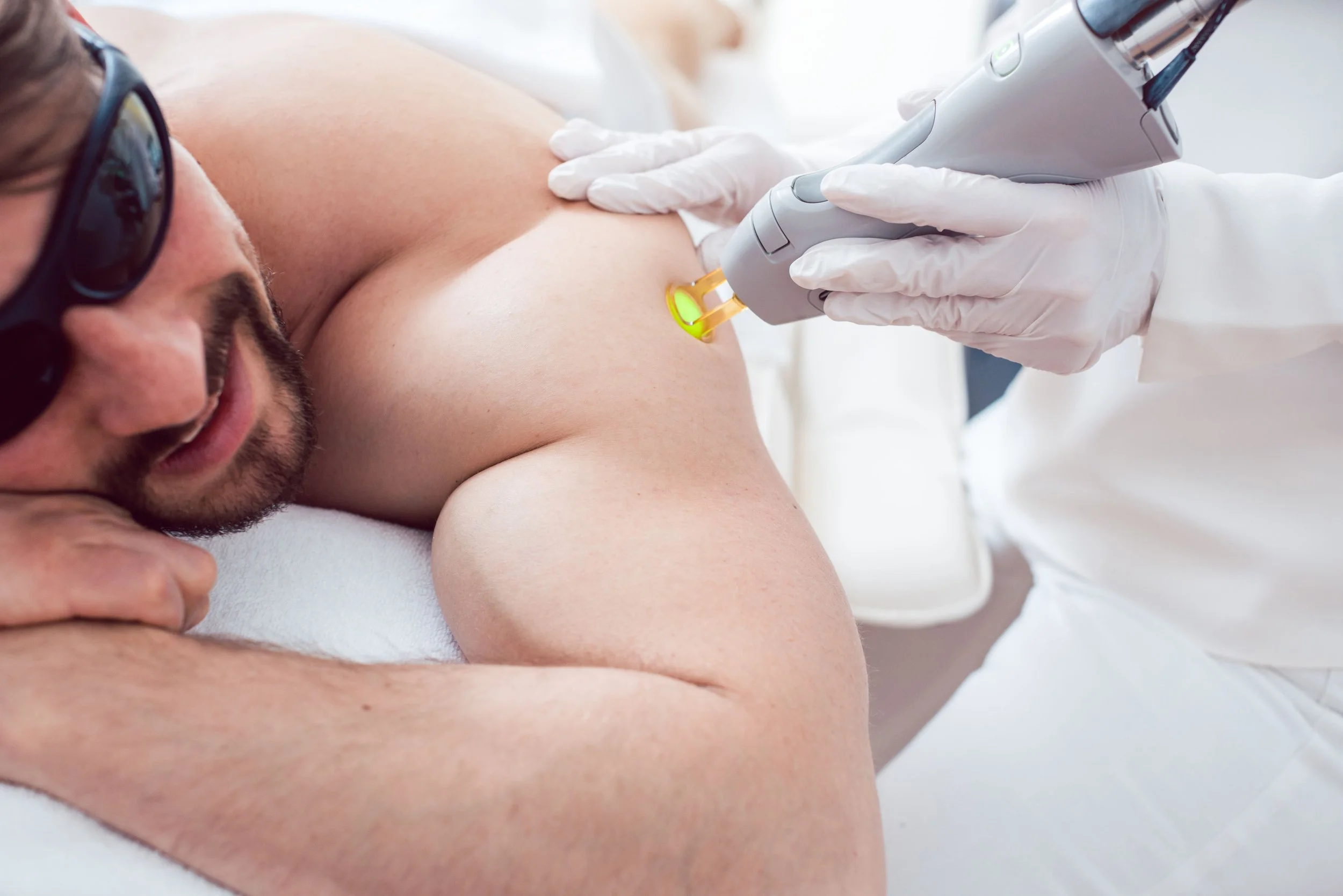 Une personne reçoit un traitement médical avec un appareil qui émet une lumière verte, probablement une procédure dermatologique, sur la peau de son bras, sous la supervision d'un professionnel en blouse blanche portant des gants.