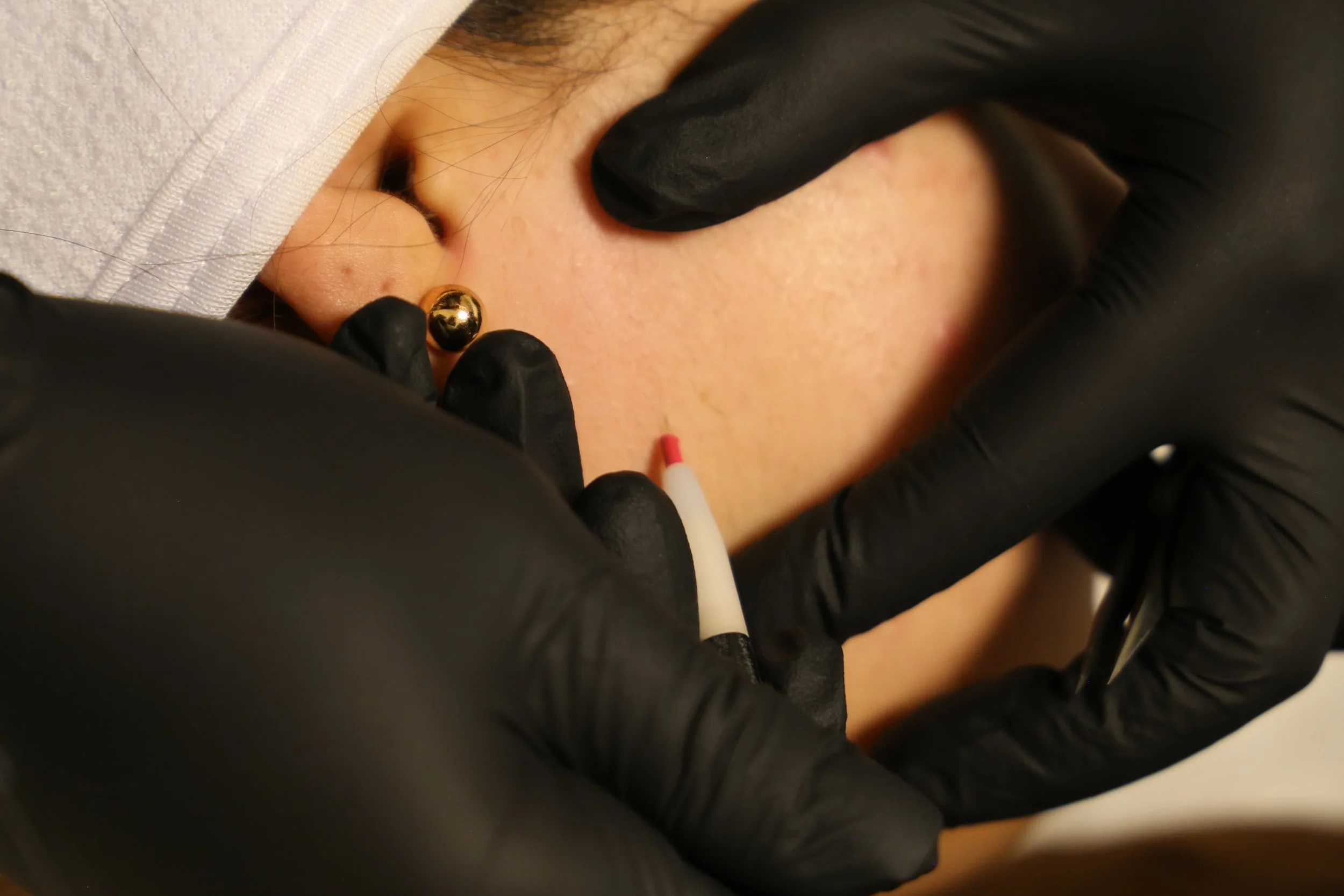 Une personne reçoit une injection ou une prise de sang dans le bras, sous la supervision d'une personne en gants noirs, avec une légère couverture ou tissu blanc en arrière-plan.