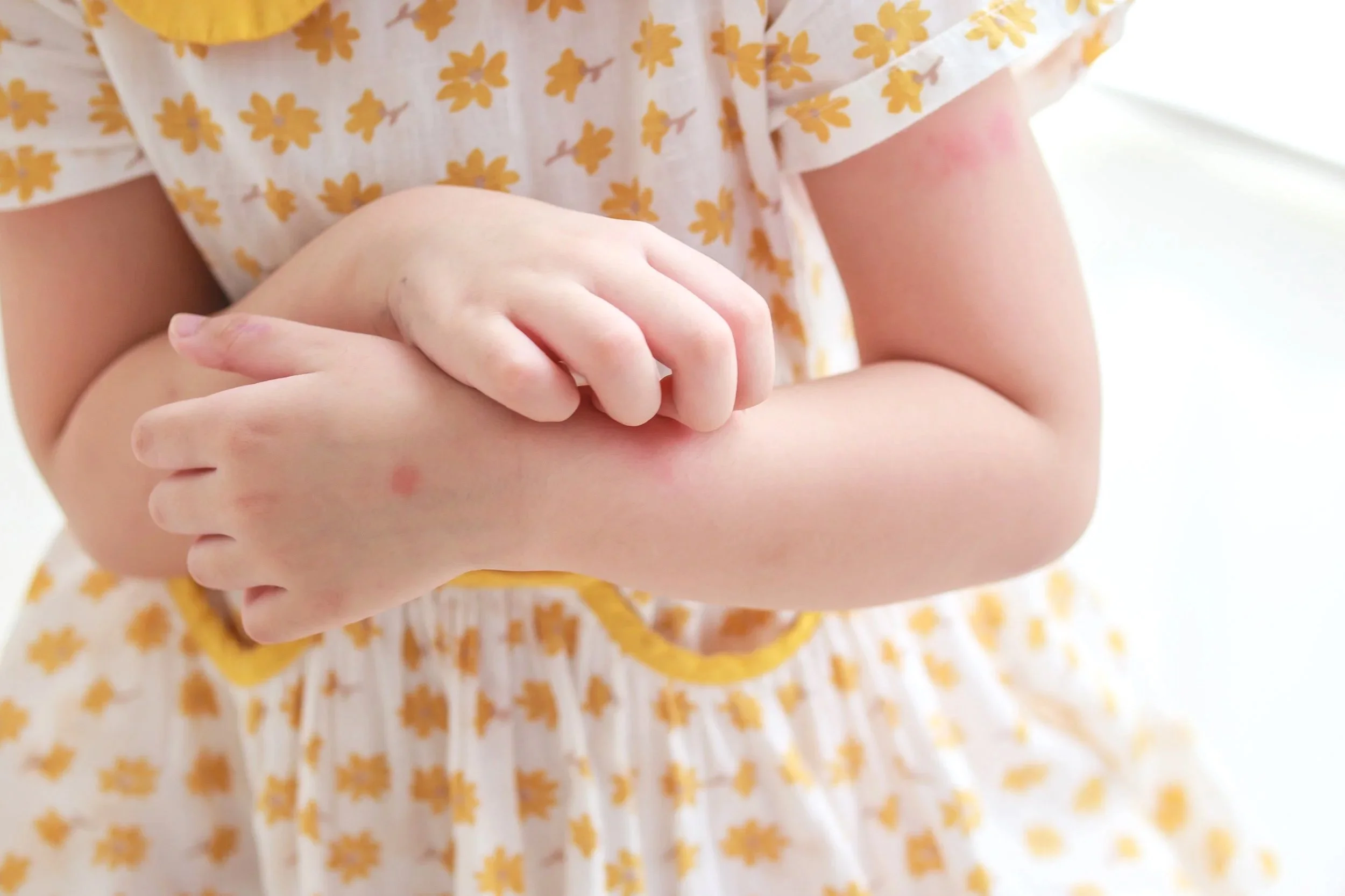 Child with skin rash on arms representing pediatric dermatology care