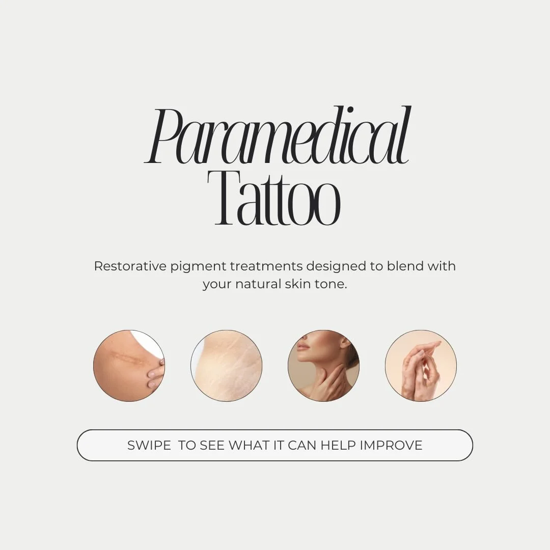 Paramedical tattooing is a restorative form of pigment work designed to improve the appearance of the skin.

It can be used to blend scars, soften stretch marks, restore pigment lost from skin conditions such as vitiligo, and in some cases improve ar