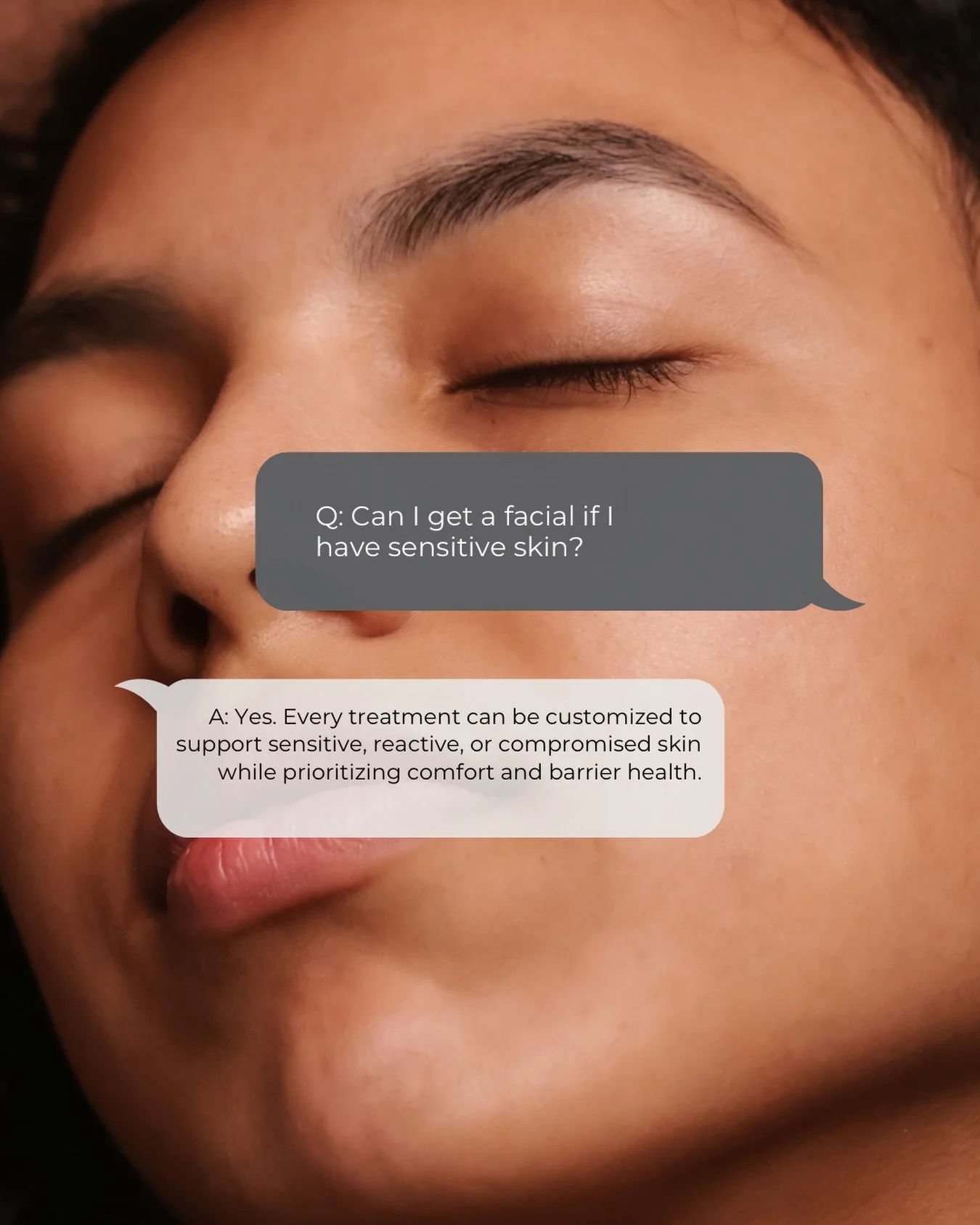 Sensitive skin? You can still enjoy a facial.

Many people worry that treatments will leave their skin feeling irritated or overwhelmed, but every facial is customized to your skin&rsquo;s unique needs.

Whether your skin is sensitive, reactive, dry,