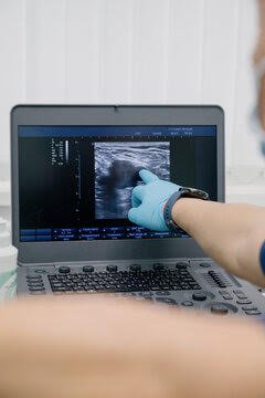 Diagnostic ultrasound images reviewed digitally as part of mobile vascular ultrasound services for physician offices in New Jersey