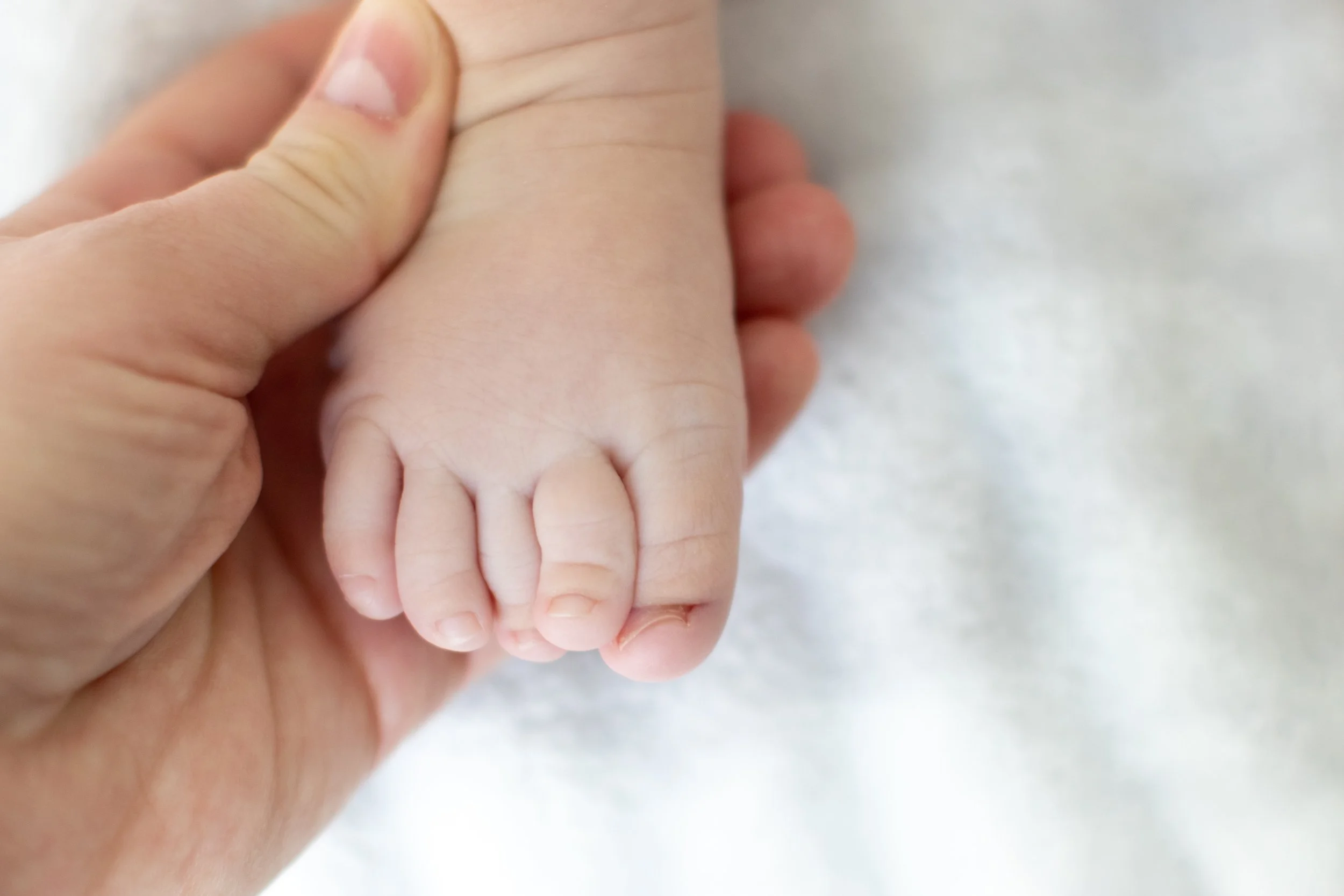 Ingrown Toenails in Children