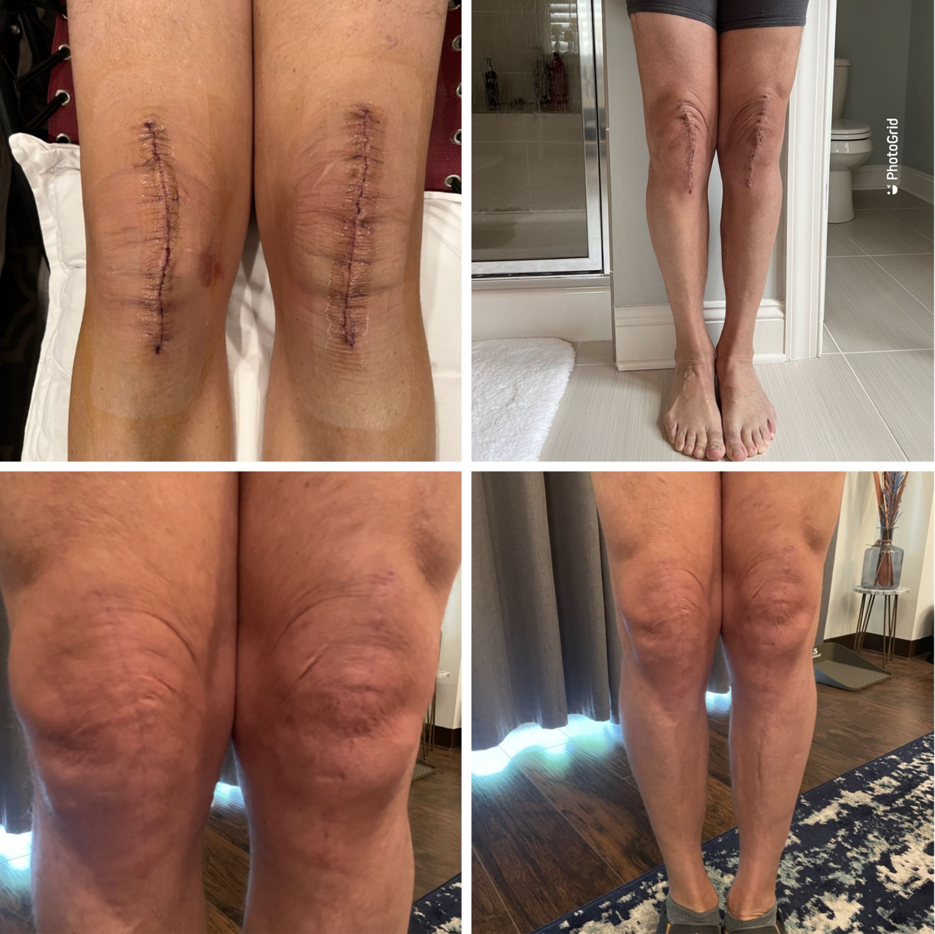 Massage therapy for scar tissue and post-surgery recovery in Huntersville NC