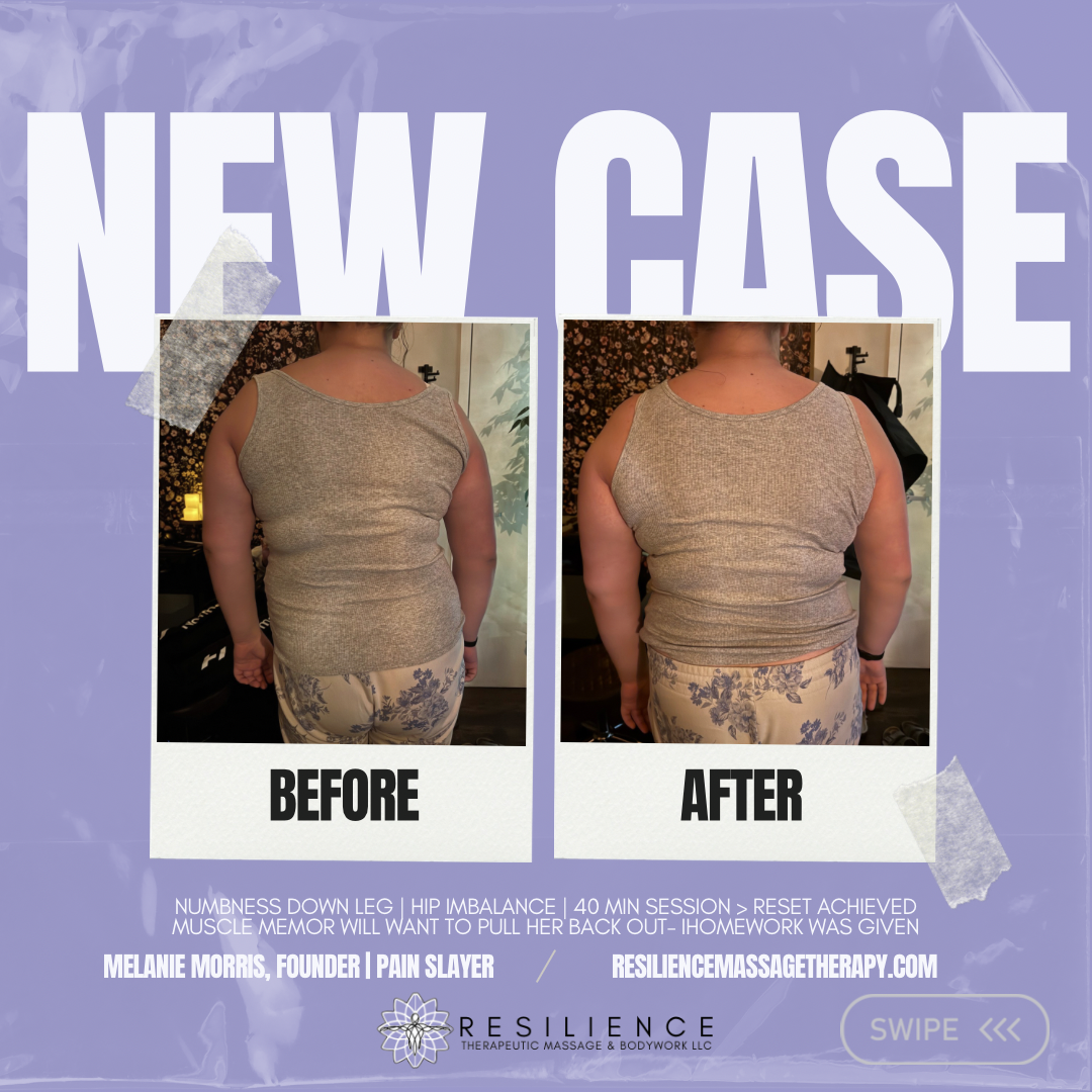 Corrective bodywork for hip imbalance and nerve pain in Huntersville NC