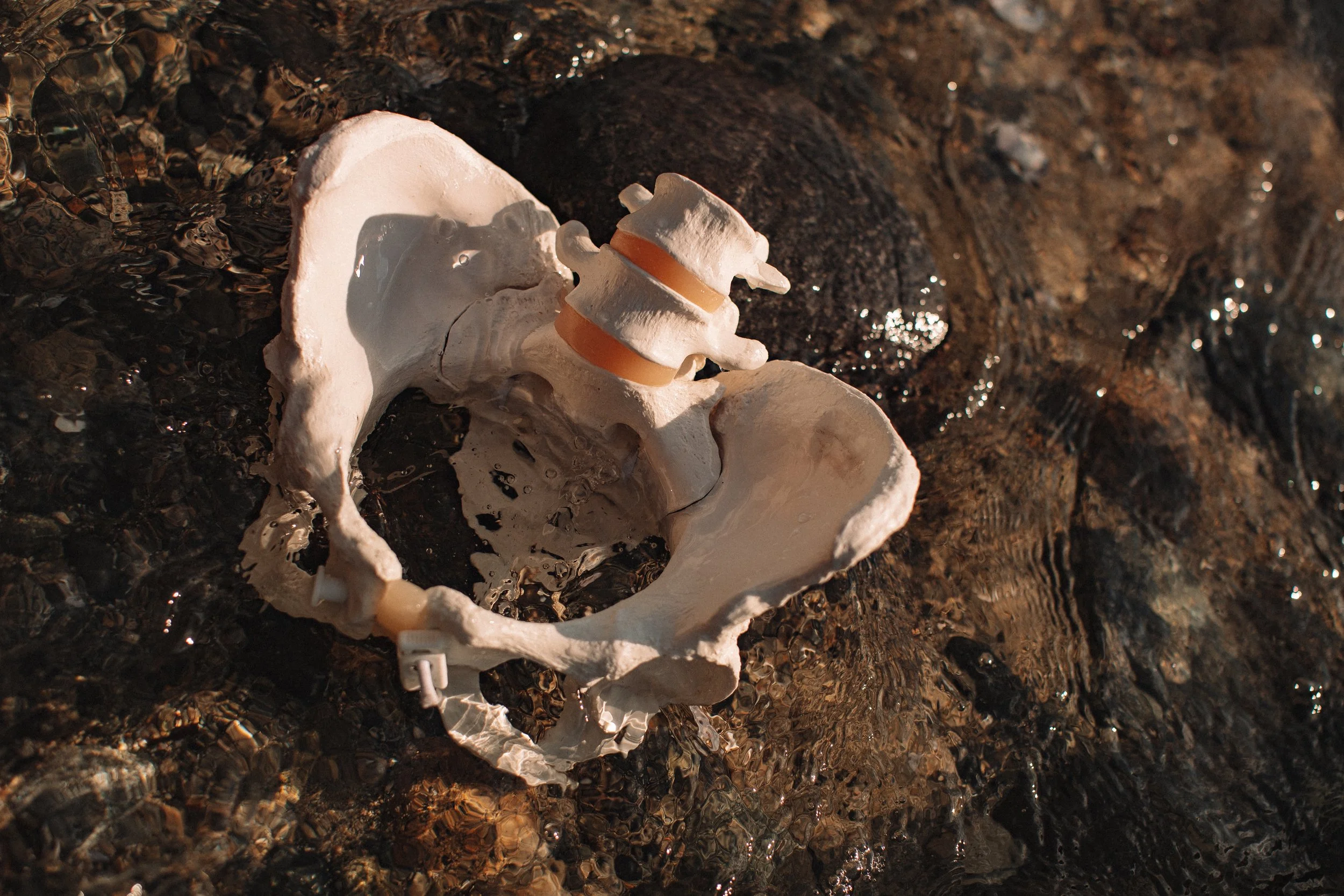 A human pelvis skeleton with an exploded lumbar vertebrae placed on it, lying on rocks in water.