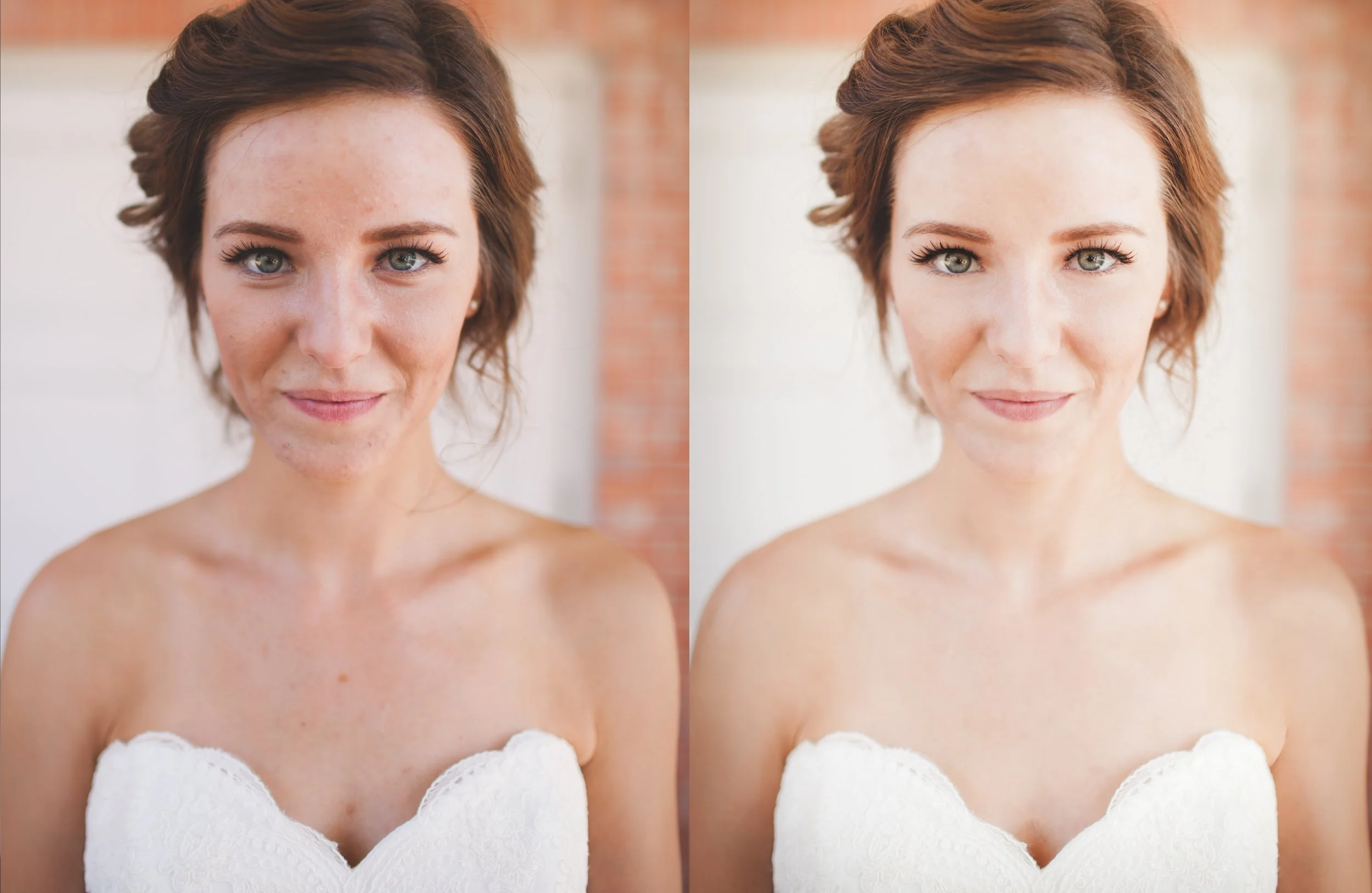 A side-by-side comparison of a woman with clear skin on the right and acne on her face on the left, wearing a white strapless wedding dress standing in front of a brick wall.