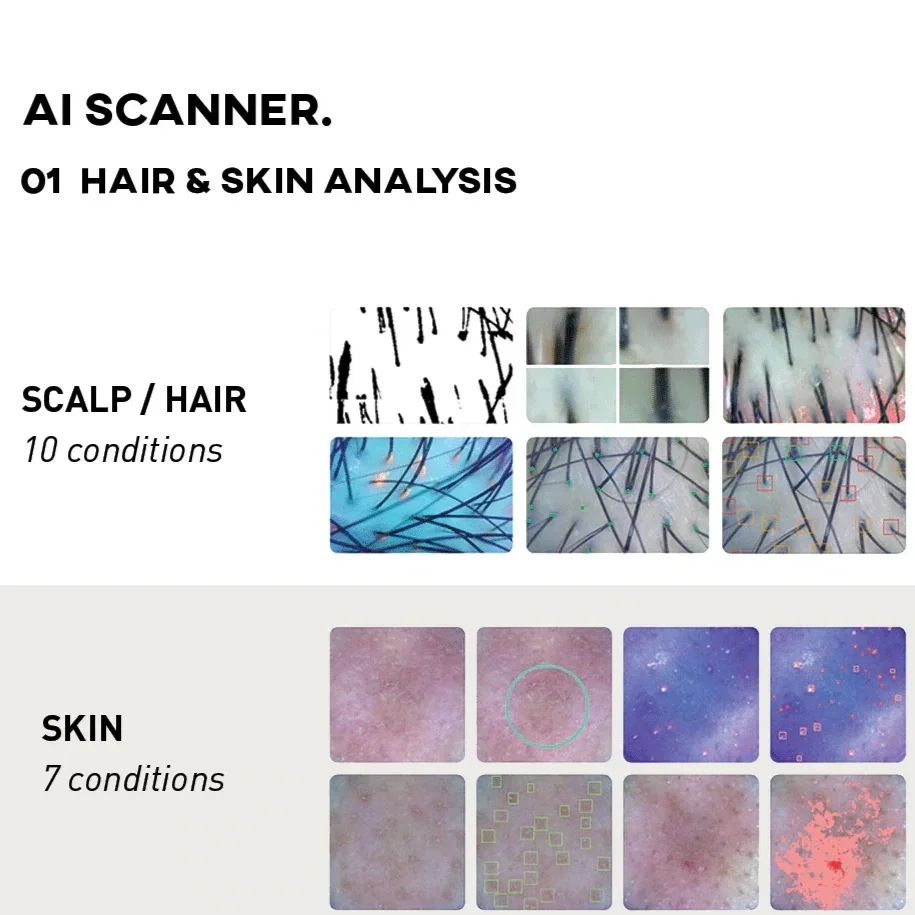 A digital poster showcasing AI scanner technology for hair and skin analysis. The poster is divided into sections displaying various conditions for scalp, hair, hair loss and skin analysis, with visual example images for each condition.