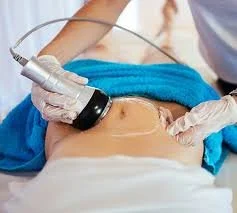 Ultrasound Fat Cavitation - Flank ( Love handles ) or Lower Abdomen