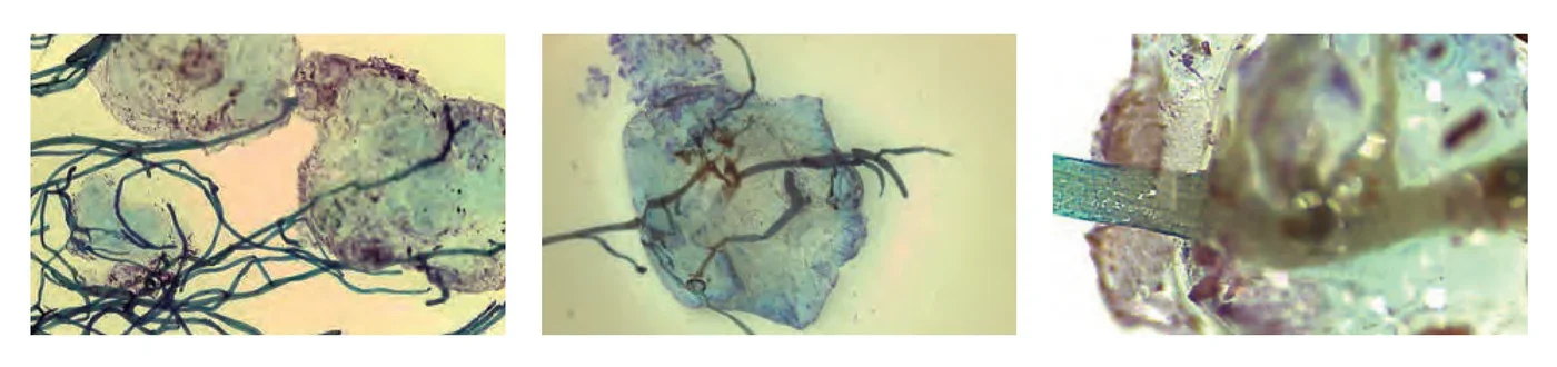Close-up images of microscopic organisms or cells with thread-like fibers and complex structures.