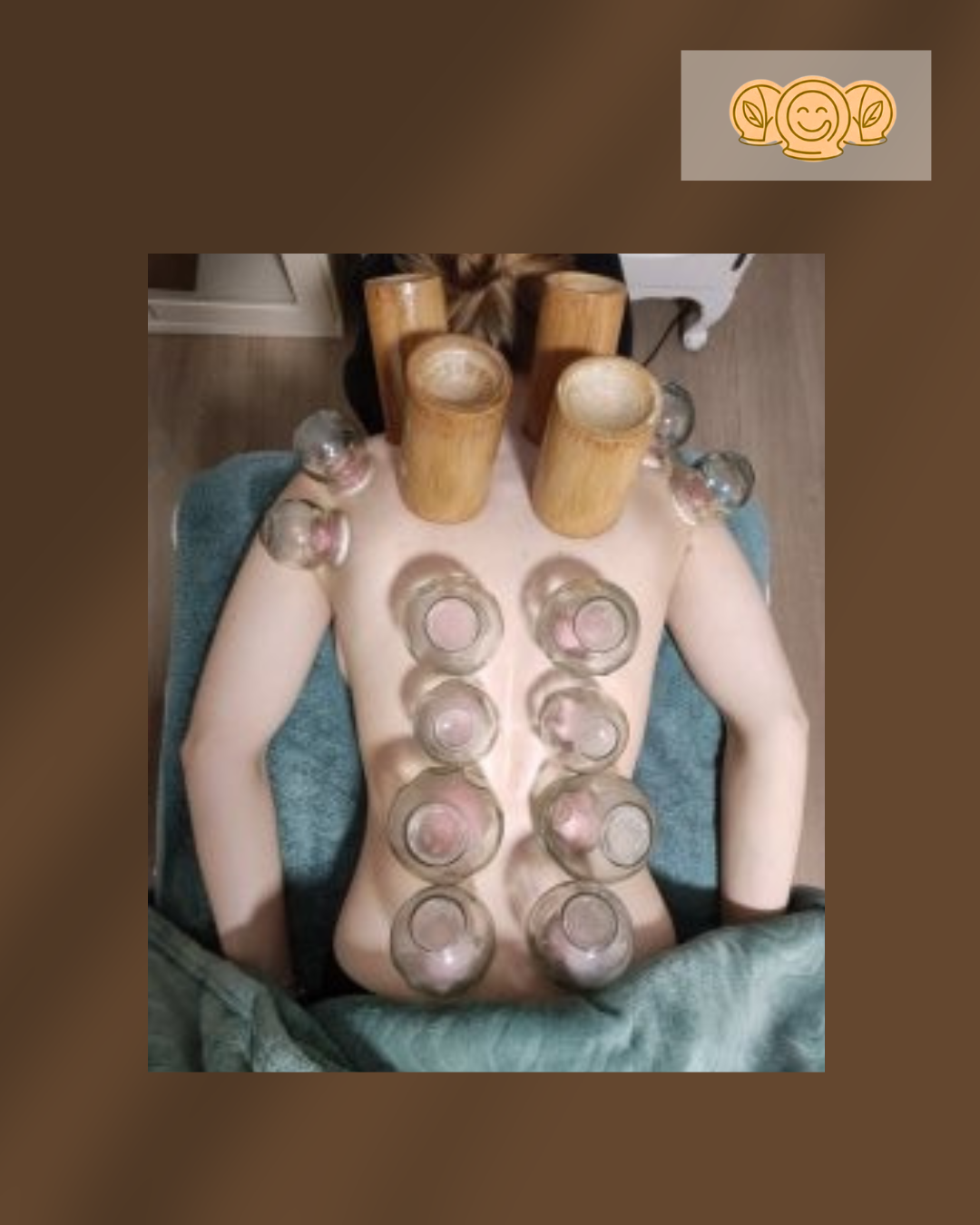Donna riceve un massaggio con candele di cera e bicchieri di vetro sul suo corpo, in un ambiente di spa o benessere.