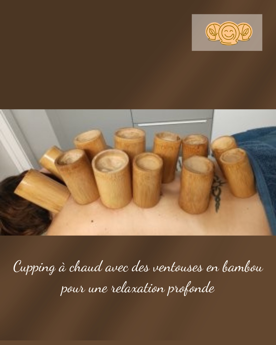 CUPPING THERAPY 1.png