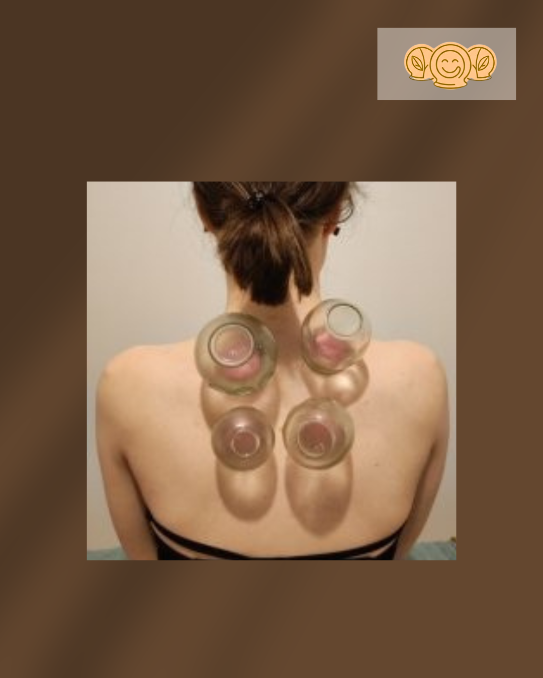 CUPPING THERAPY 3.png