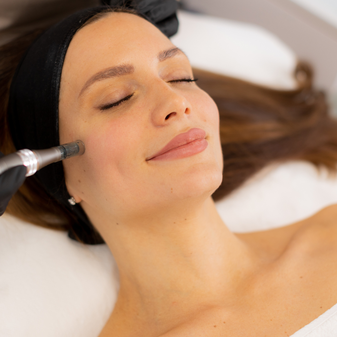 Medspa in Ventura, CA, 93001 | Microneedling Near Me