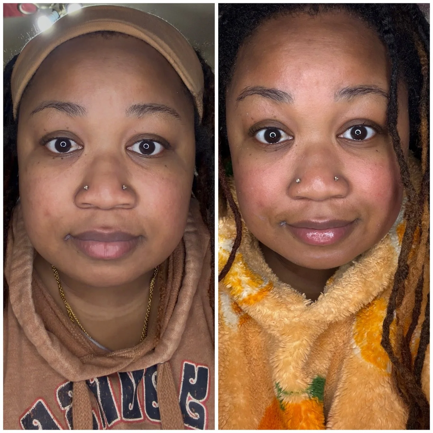 I received samples from @haleandhush They are formulated for sensitive skin so I had to try it out 🤭 so far I&rsquo;m impressed with the results! 

(Same lighting, i used the cleanser, mask, toner, serum, moisturizer, eye serum, and finished it off 