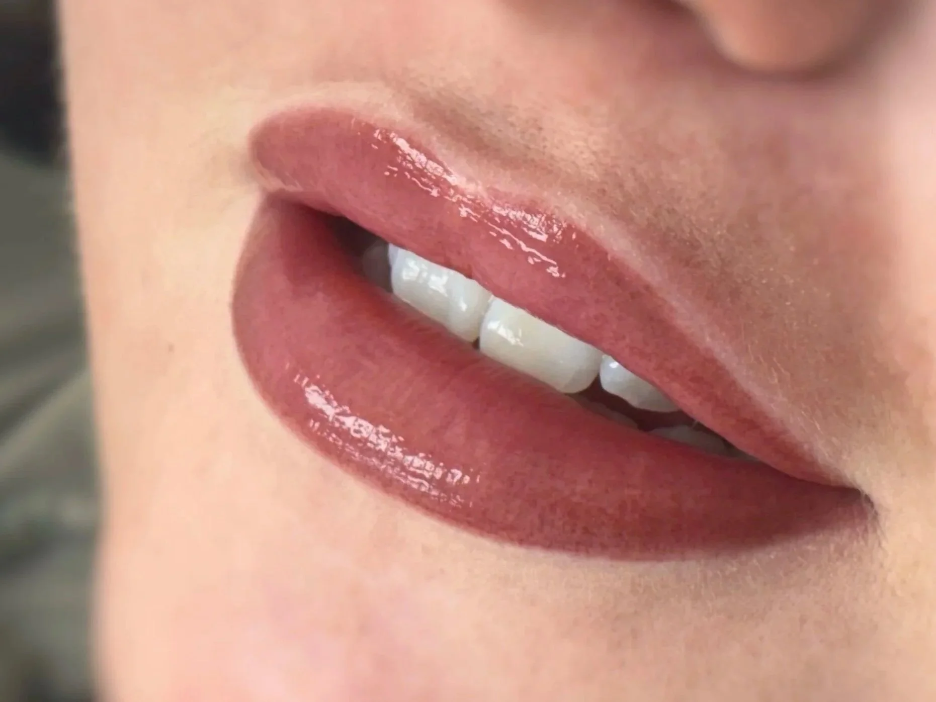 Close-up of glossy pink lips slightly parted, showing white teeth.