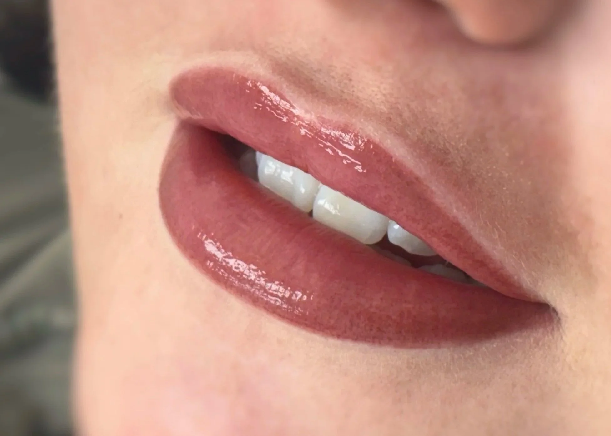 Close-up of glossy mauve lips slightly parted, showing white teeth
