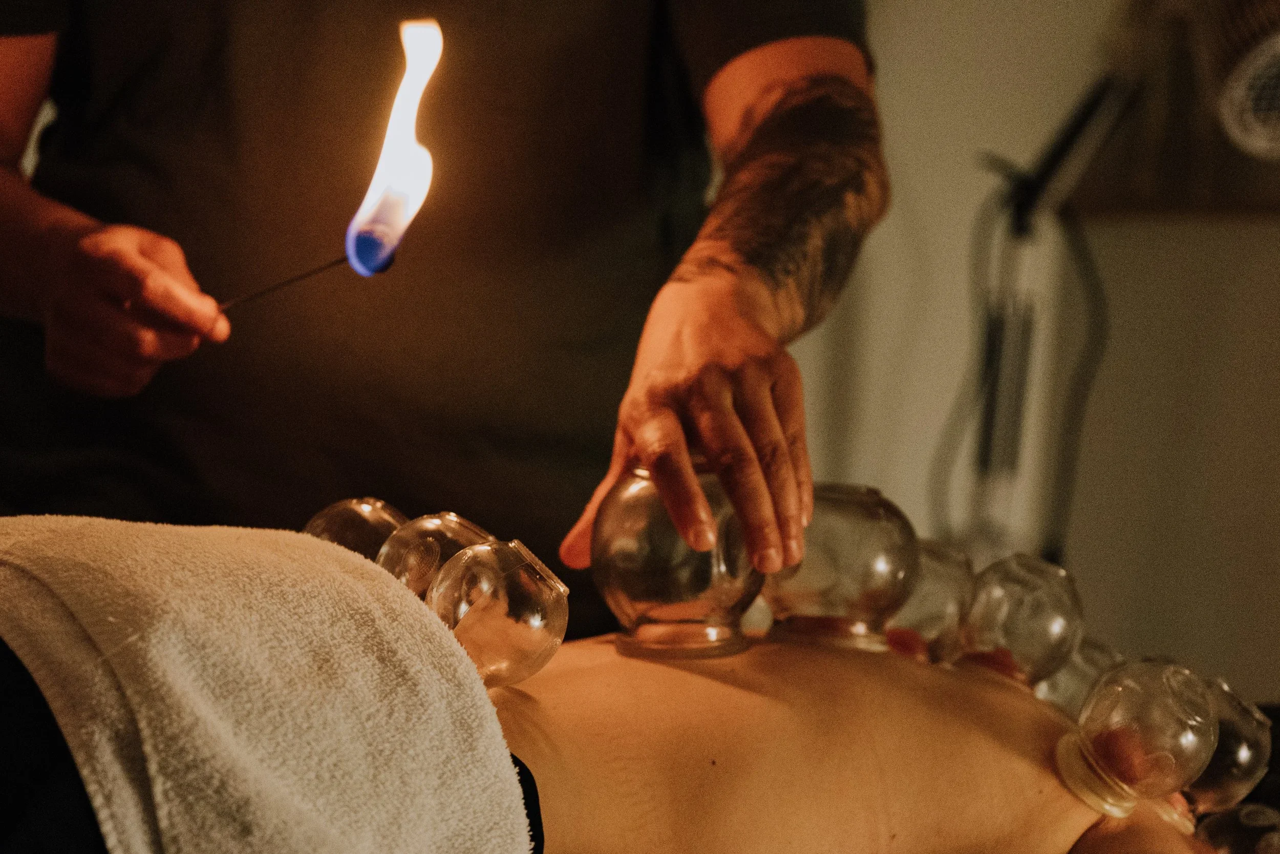 Firre cupping 2 .webp