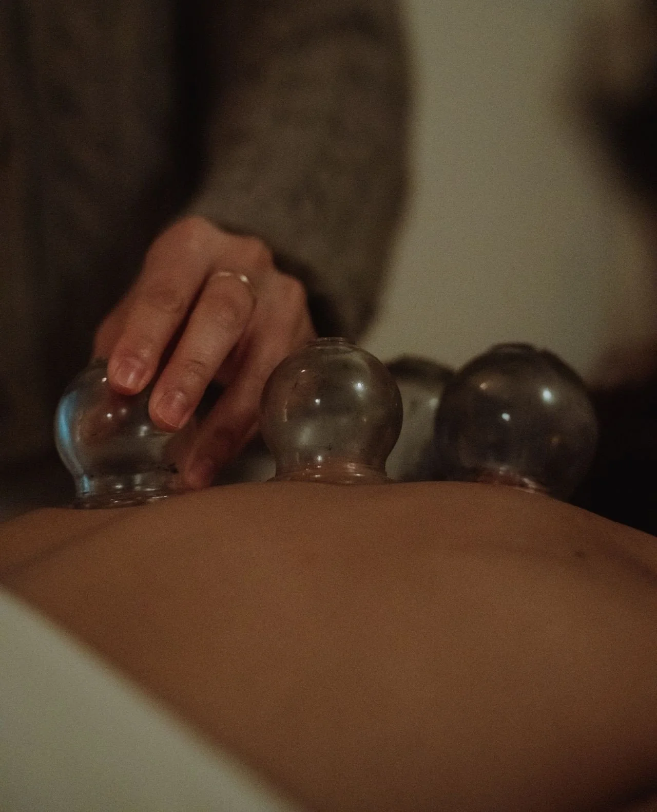 A small addition that can make a big difference.⁠
⁠
Cupping can be added to your acupuncture treatment to help release tension, improve circulation, and support recovery in a deeper way.⁠
⁠
It&rsquo;s especially helpful if you&rsquo;ve been feeling t