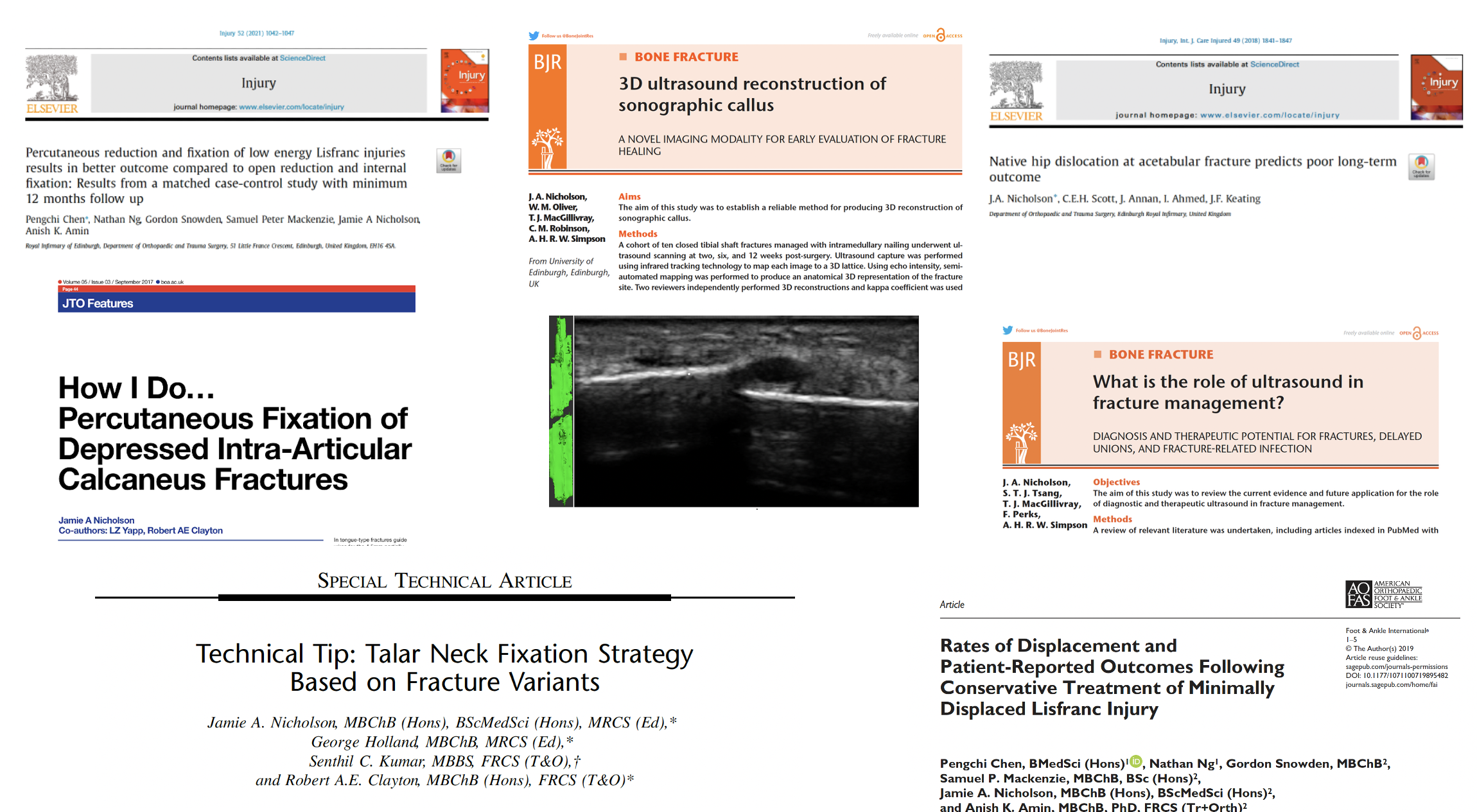 Screenshot of multiple academic journal pages related to orthopedic injuries and fracture treatments, including ultrasound and fixation strategies.