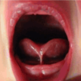 Open mouth showing the tongue and the inside of the throat.