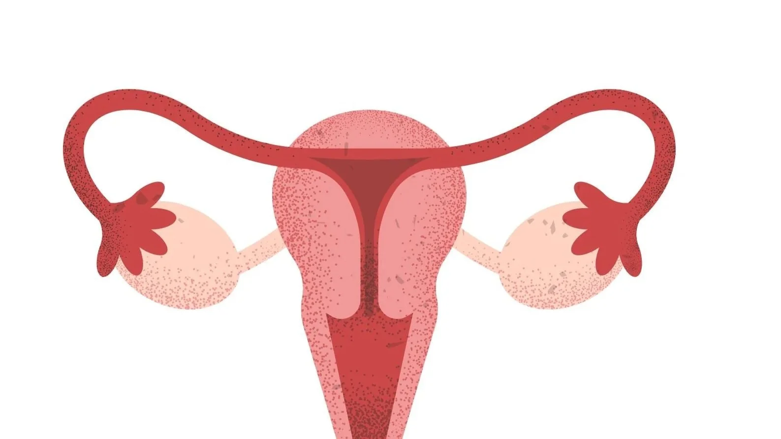 PCOS to PMOS: Why the Name Is Changing And How Nutrition &amp; Lifestyle Changes Can Help