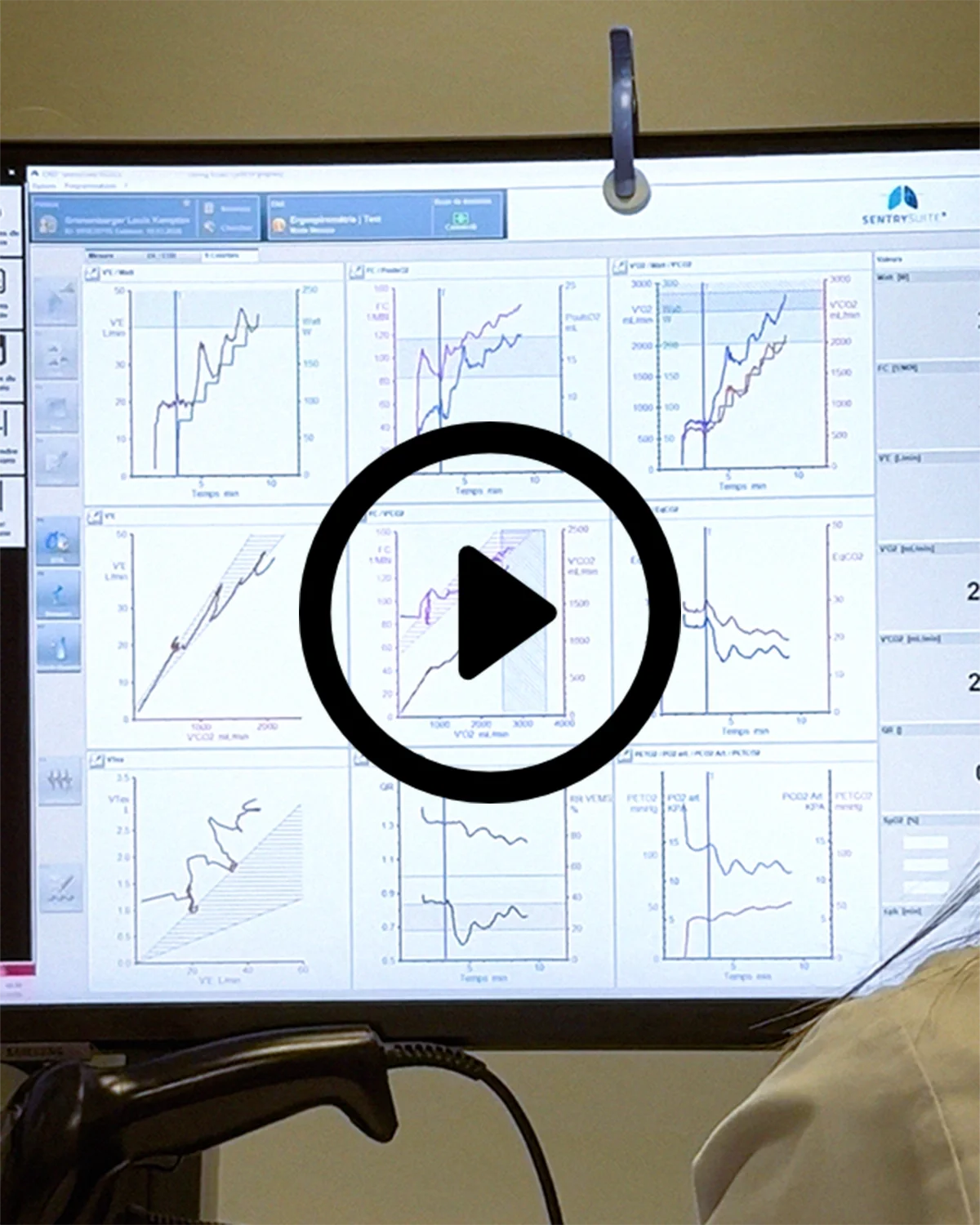 Présentation de plusieurs graphiques médicaux ou scientifiques sur un écran d'ordinateur lors d'un test VO2Max (ergospirométrie), et un bouton de lecture en surimpression au centre.