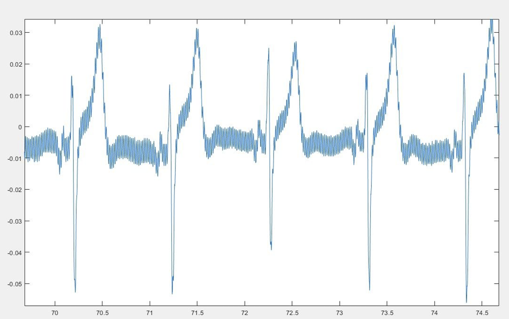 Raw heart signal collected from ECG.