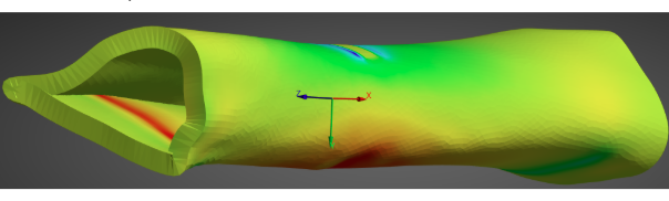 ANSYS normal elastic strain map showing max strains at loading site.