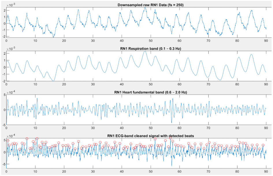 My own raw and processed data collected while I lay on my right side.