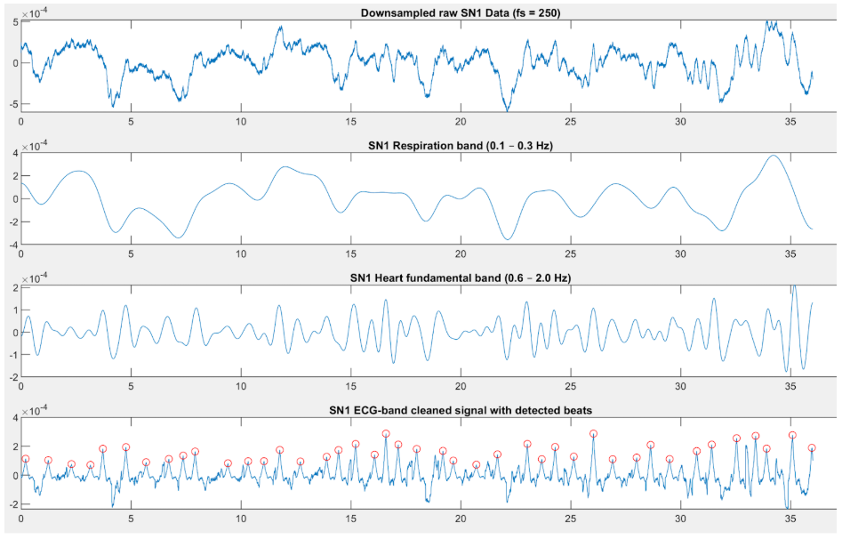My own raw and processed data collected while I lay on my stomach.