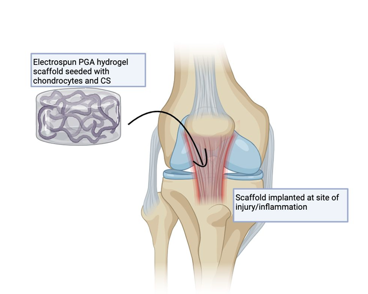 Diagram of a knee joint showing a scaffold implanted at an injury site with a label pointing to it, and an inset illustration of a hydrogel scaffold seeded with chondrocytes and CS.